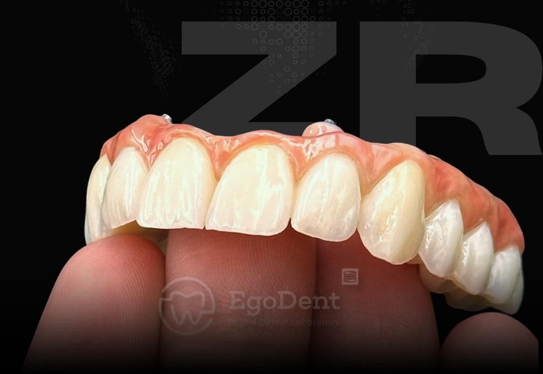 Dental Implants — EgoDent Dental Clinic