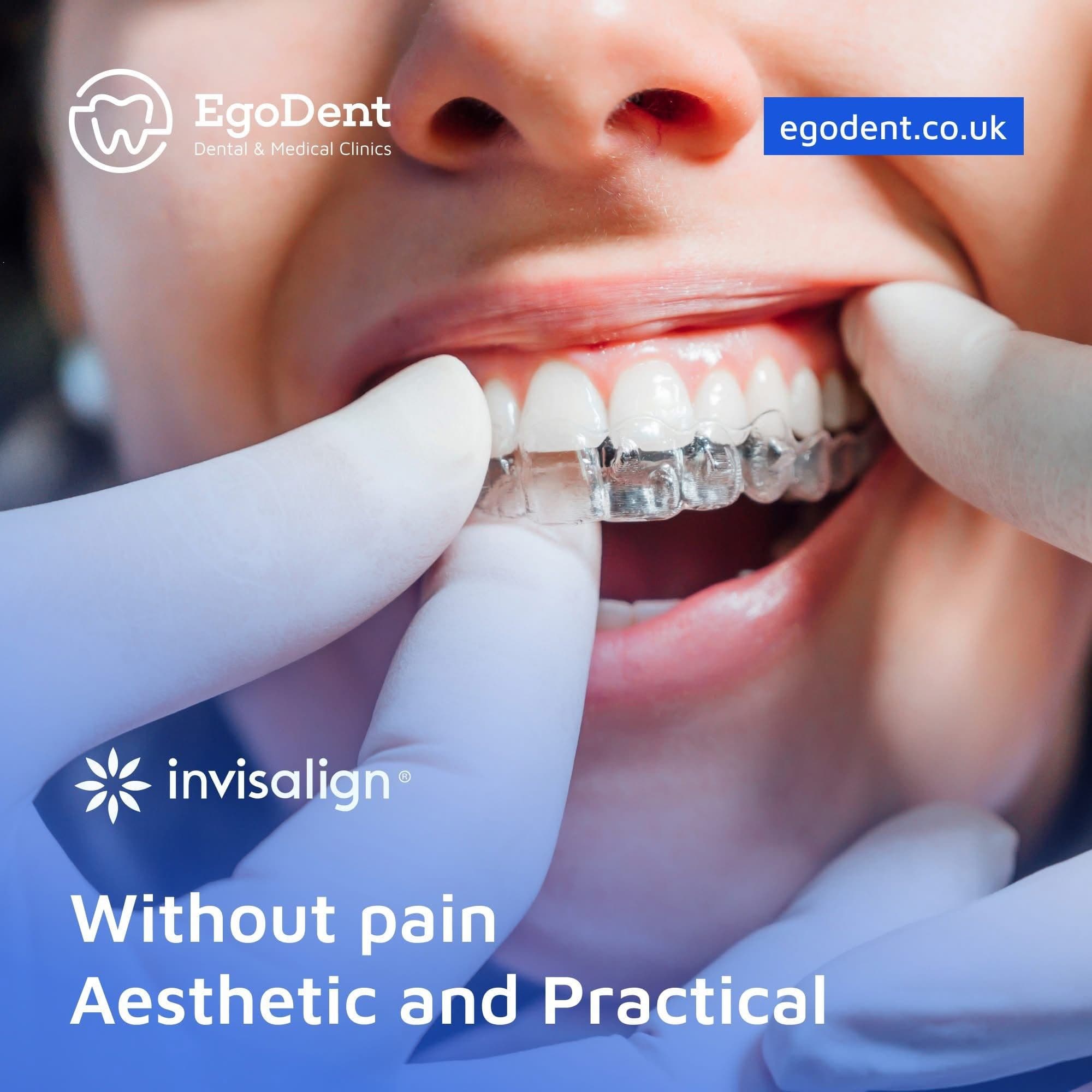 Orthodontics & Aligners — EgoDent Dental Clinic