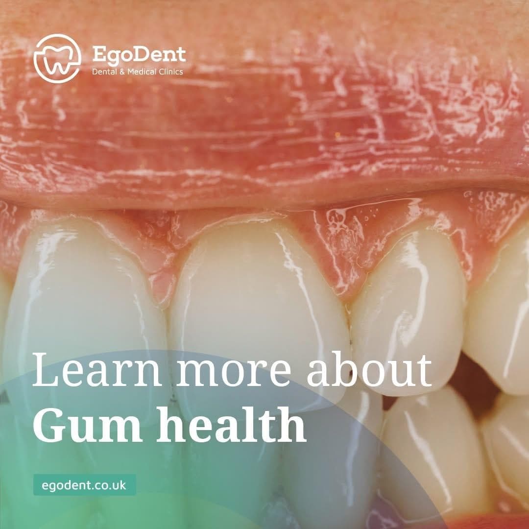 Gum Health & Periodontics — EgoDent Dental Clinic